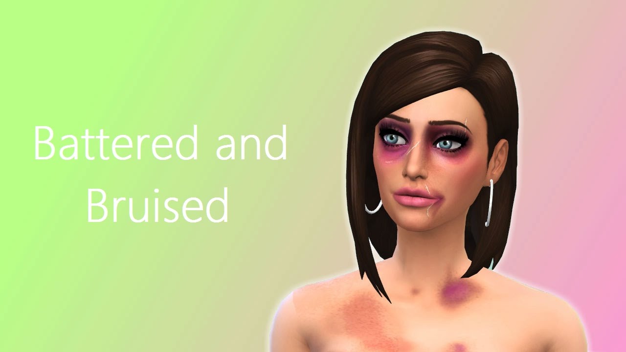 Sims 4 Cc Bruises